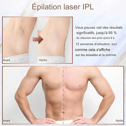 Épilateur Laser IPL Épilation Définitive Multifonction -10°