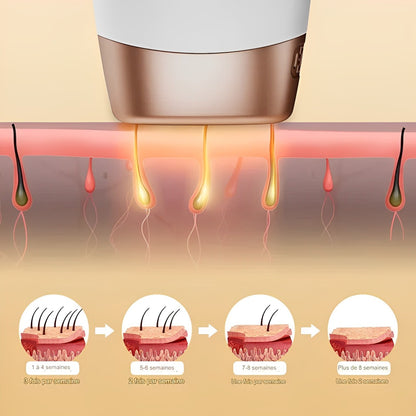 Épilateur Laser IPL Épilation Définitive Multifonction -10°