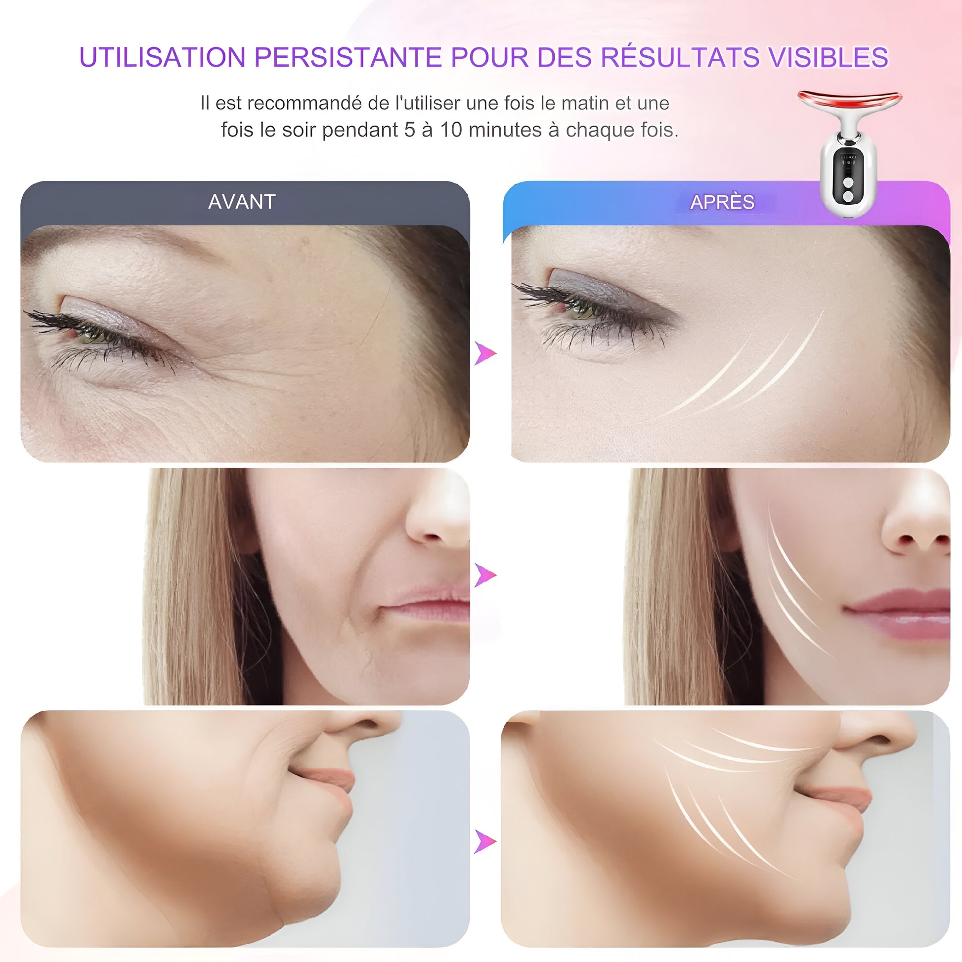 Anti-rides EMS Visage & Cou avec Lumière Rouge - Body Ultime